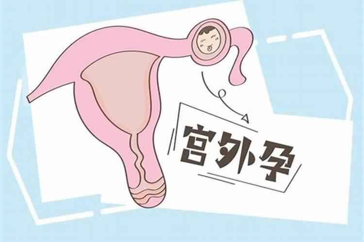 宫外孕要不要超度亡灵