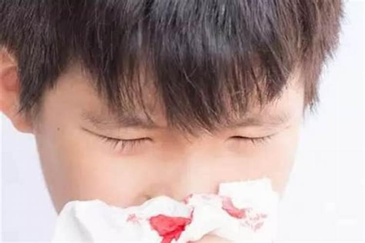 梦见别人流了很多鼻血？