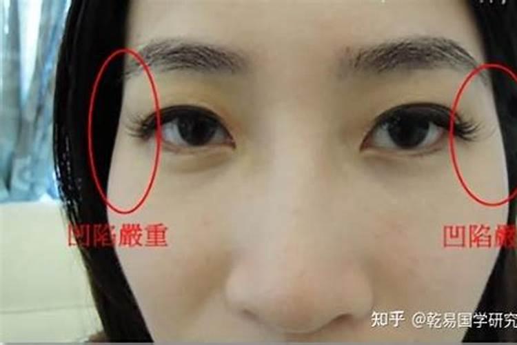 夫妻宫凹陷导致婚姻不顺