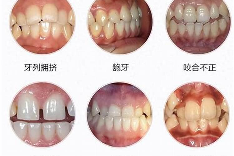 牙齿不齐婚姻不顺