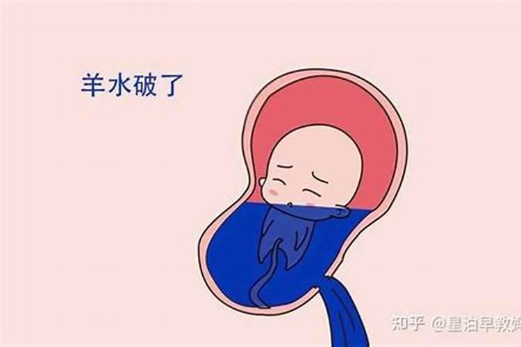 梦见科室孕妇羊水破了