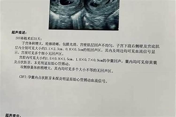 给打了胎的做法事