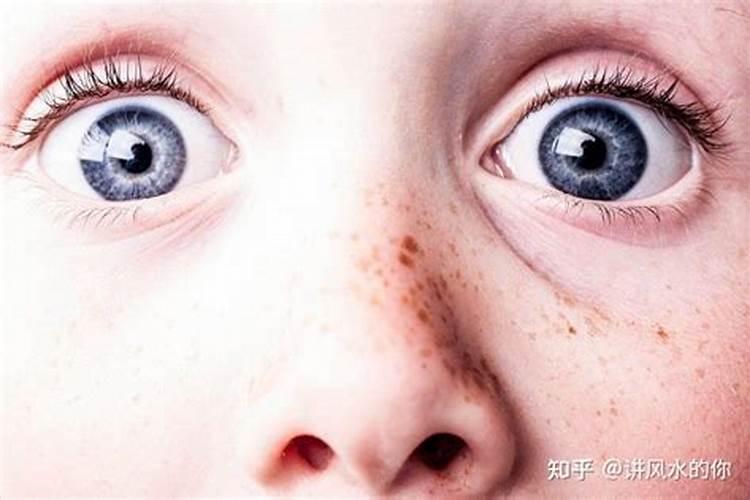 有小人痣如何化解？