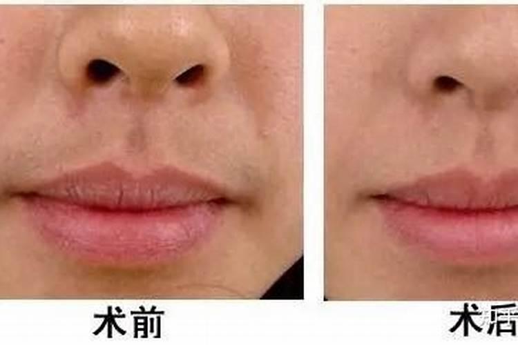 脱唇毛会影响运势吗？
