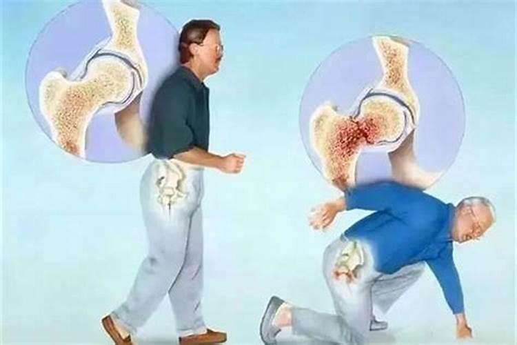 梦见老人摔倒流血死了是什么意思？