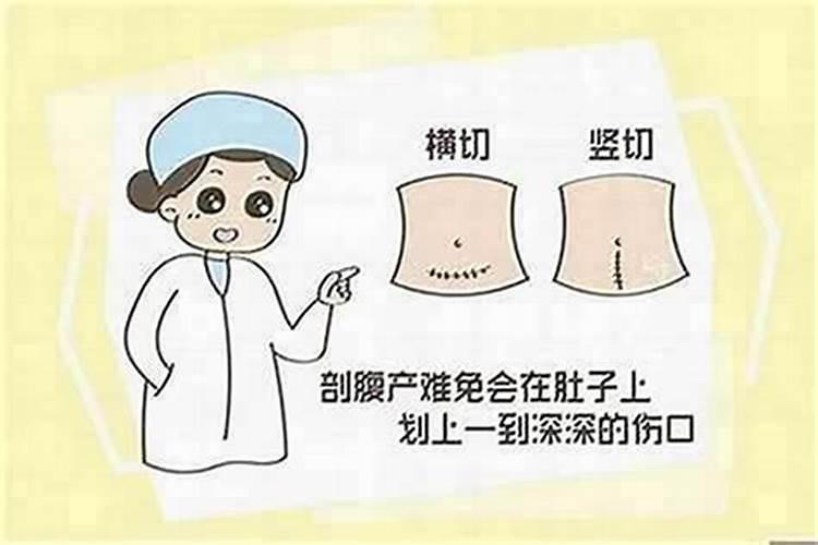剖腹产选日子是根据什么选？