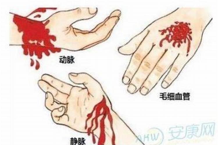 梦见手流血什么预兆？