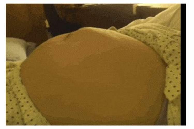 离异者梦见自己怀孕胎动鼓包