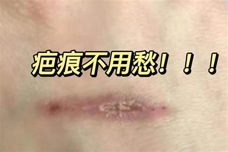 梦见妻子身上有伤疤