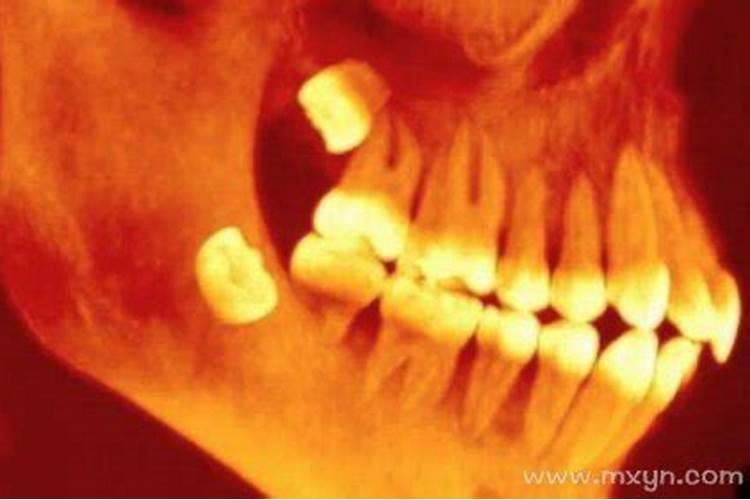 梦见牙松了是什么意思？