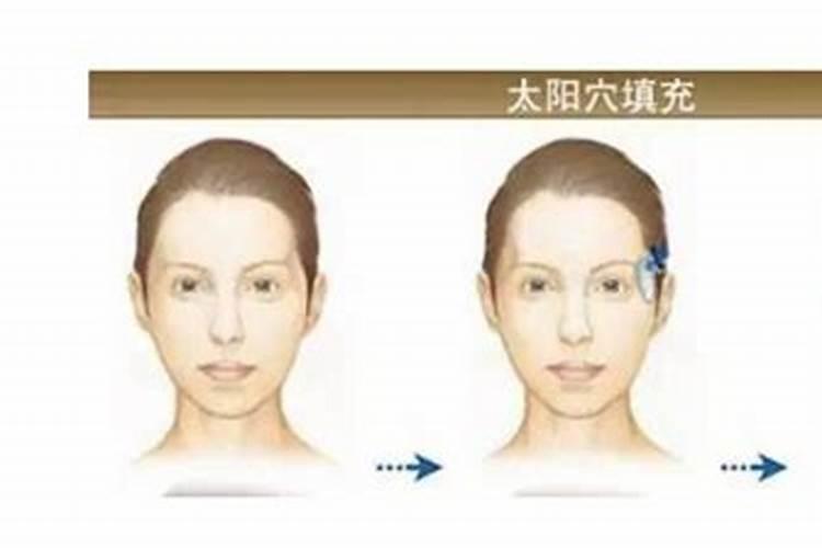 太阳穴会影响运势吗？