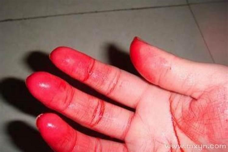 梦见手流血了怎么回事？