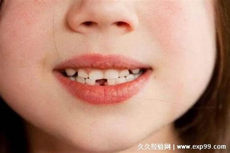 梦见孩子掉牙什么预兆？