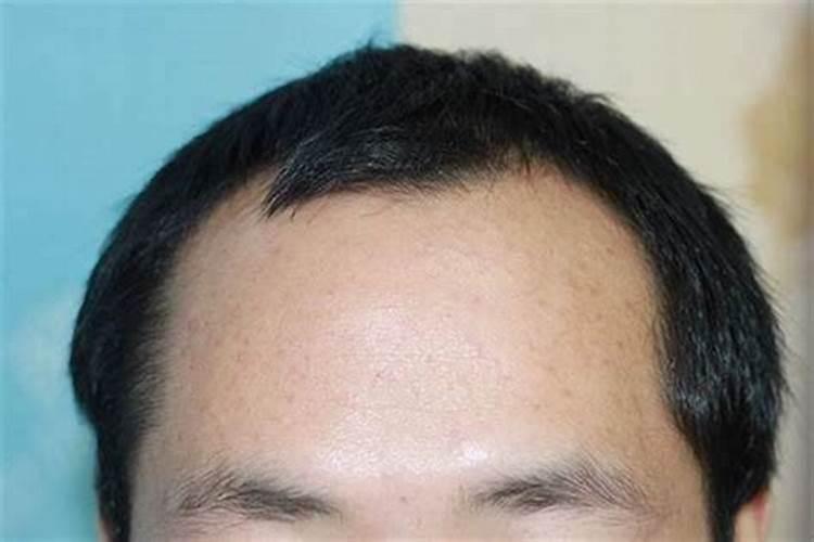 童子命的人额头高吗？