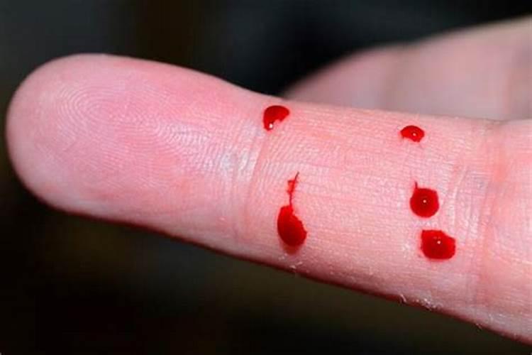 梦见弟弟的手被蛇咬了