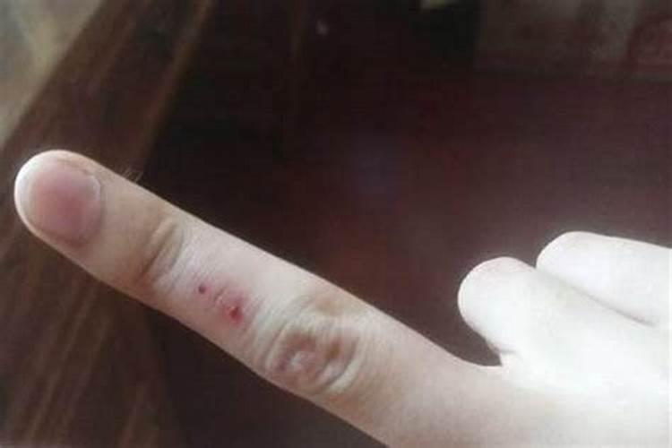 梦见男人手受伤流血