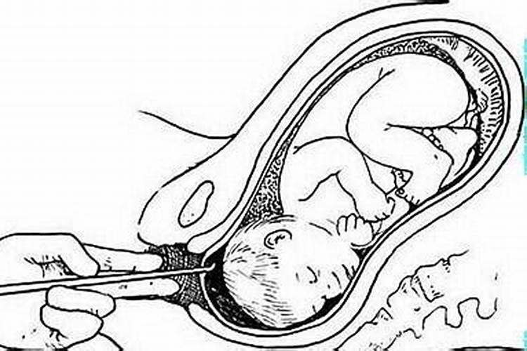 引产的孩子如何做法事？