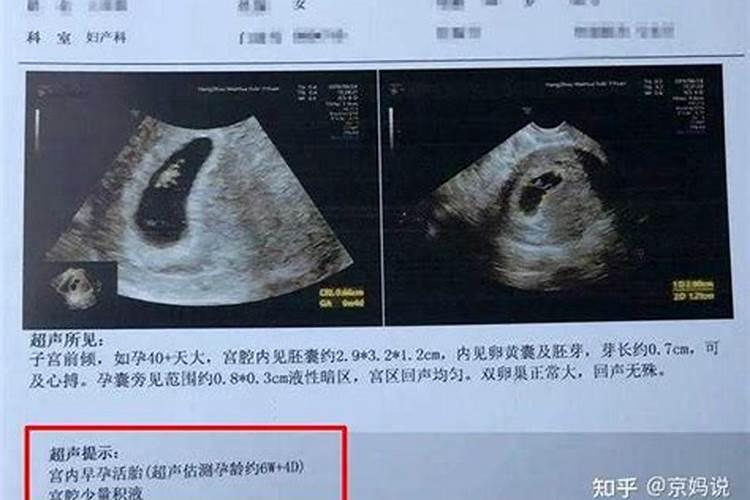 怀孕多久堕胎需要超度？