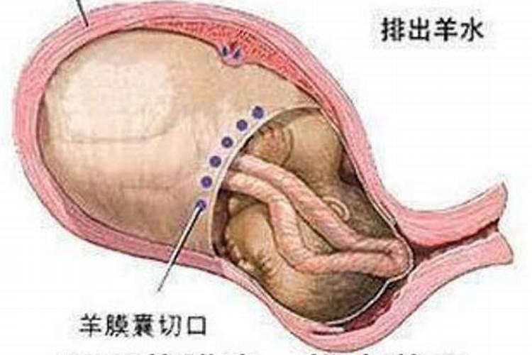 去看小产的人影响运势吗？