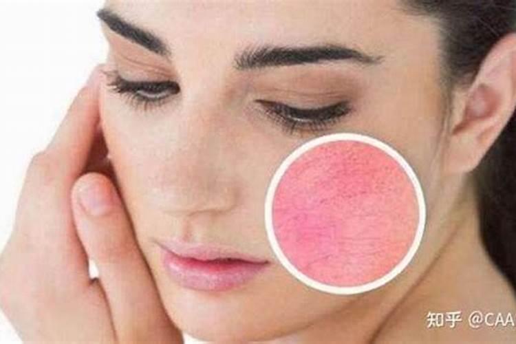 梦到自己的脸晒黑了