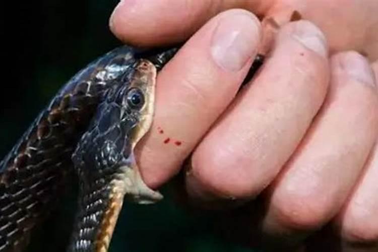 梦见被蛇咬了好几口？