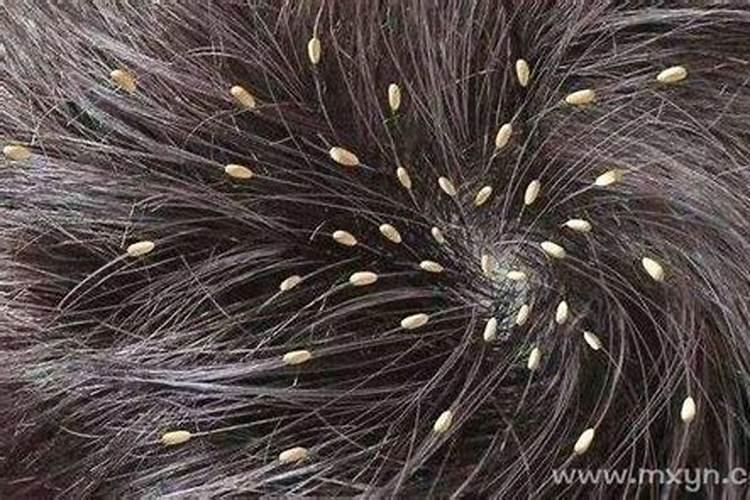 梦见孩子头上长虱子是什么意思呀？