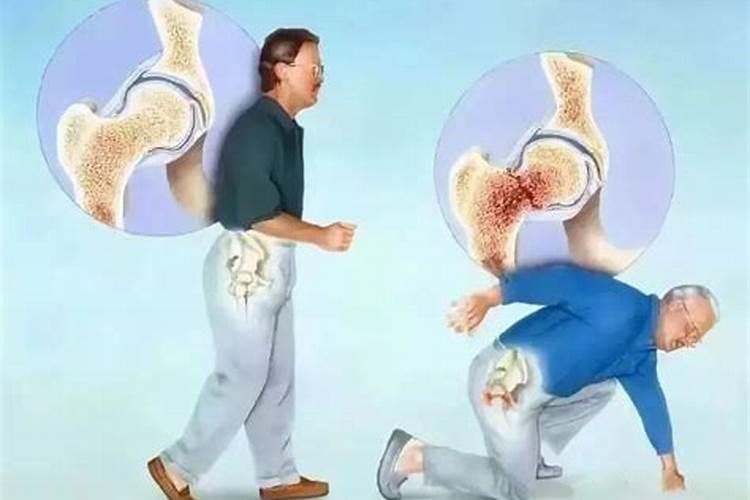 梦见老人摔倒骨折了