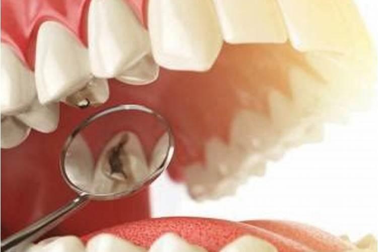 梦到牙松动是什么预兆？