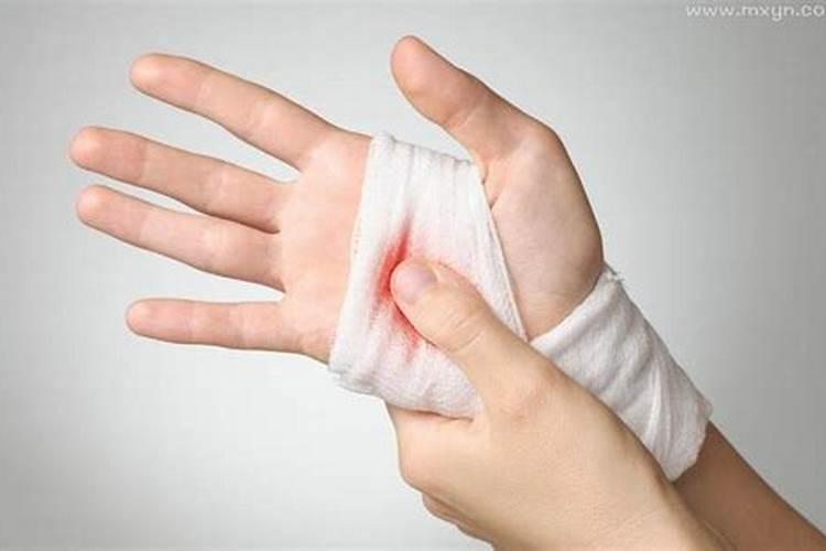 梦见受伤的手已经好了